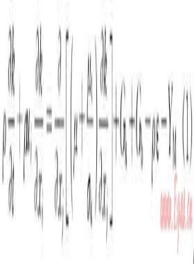 埋地與架空輸氣管道泄漏數(shù)值模擬對(duì)比分析