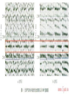 四川盆地元壩氣田超深層礁灘氣藏儲層氣水識別技術